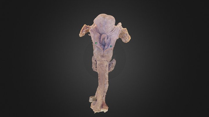Human Larynx 3D Model