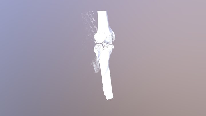 Tibia Combined 3D Model