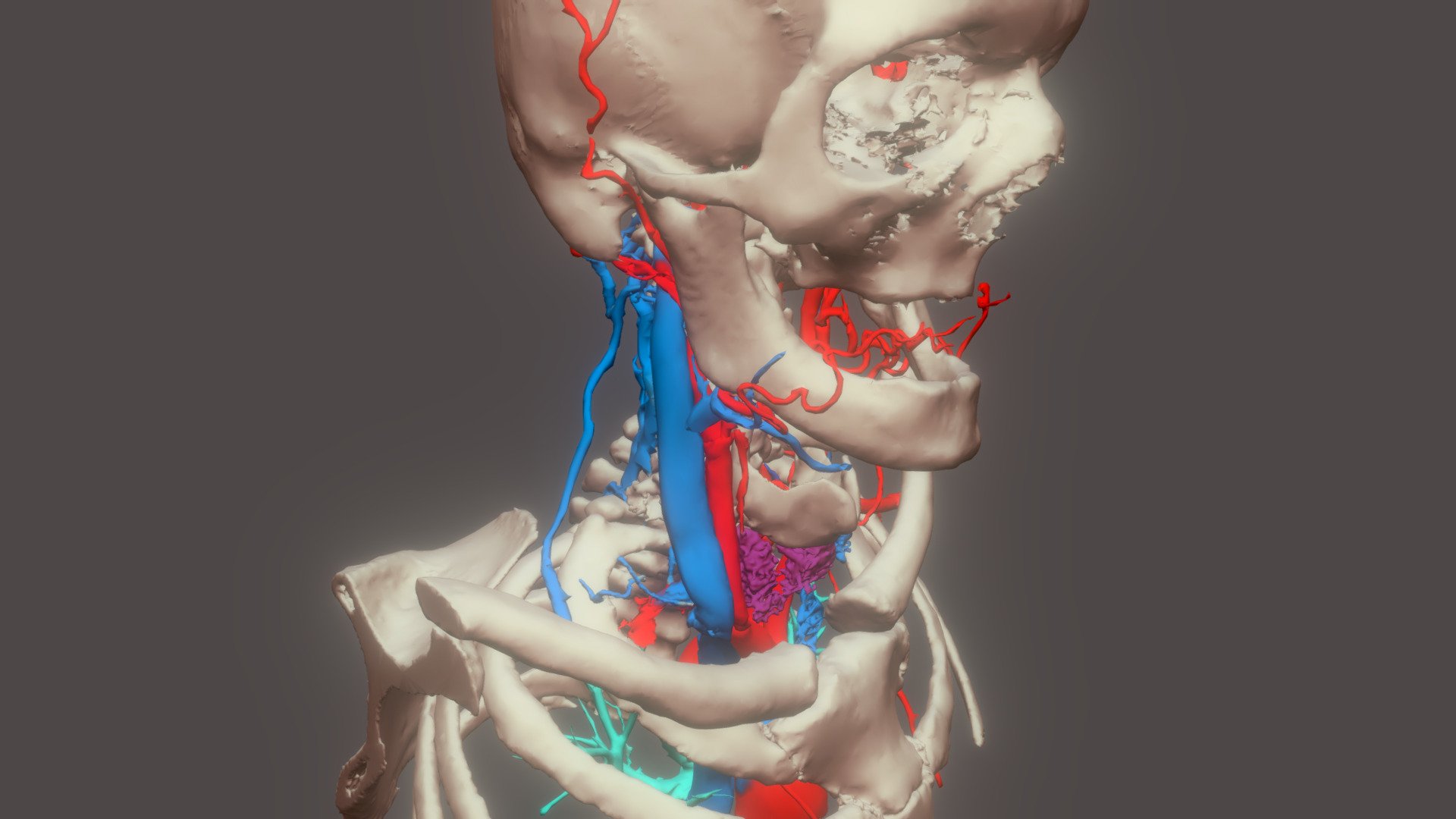 TETE VASCULAIRE (Angio CT) - 3D model by Chair_Digital_Anatomy [9d05ec9 ...