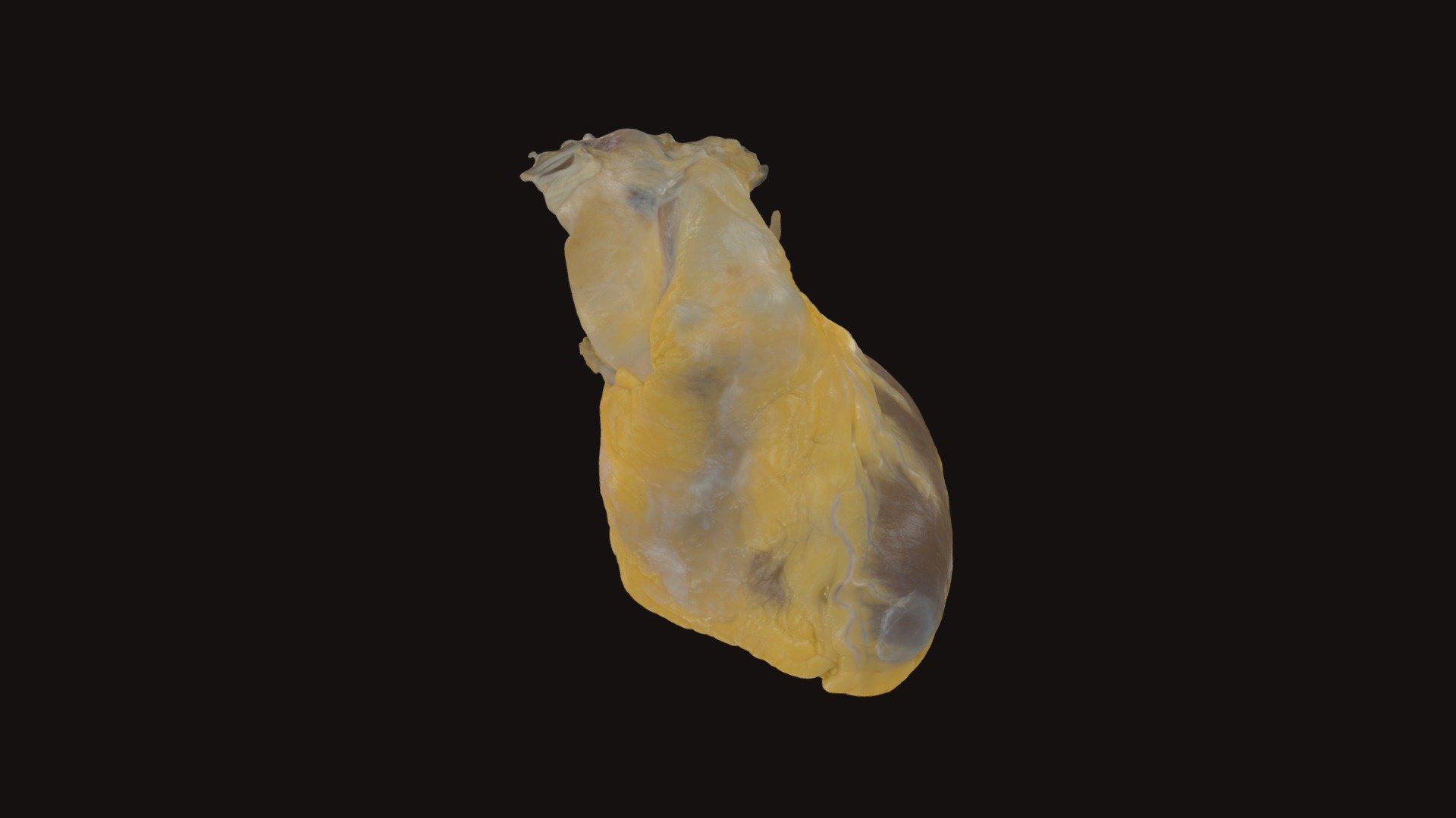 Perfusion Fixed Whole Human Heart #597