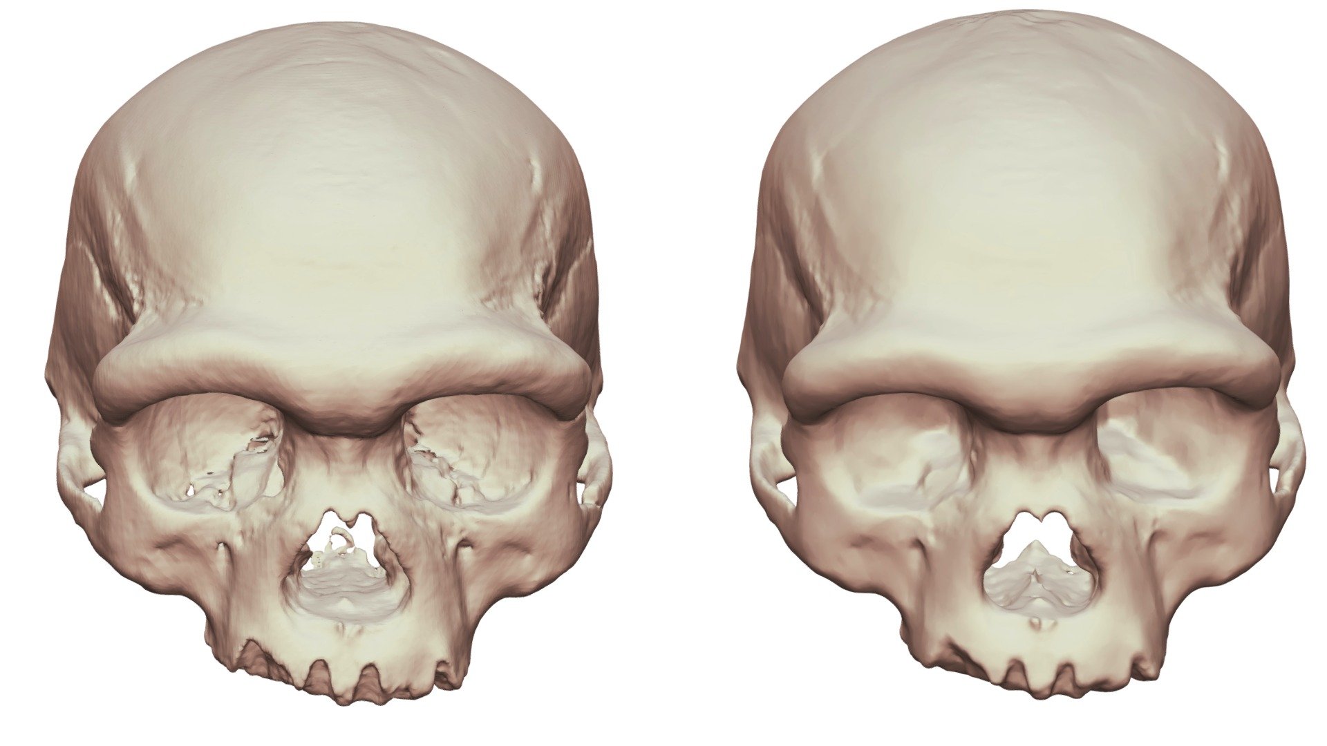 Harbin Cranium Comparison — Sketchfab embed 3D viewer