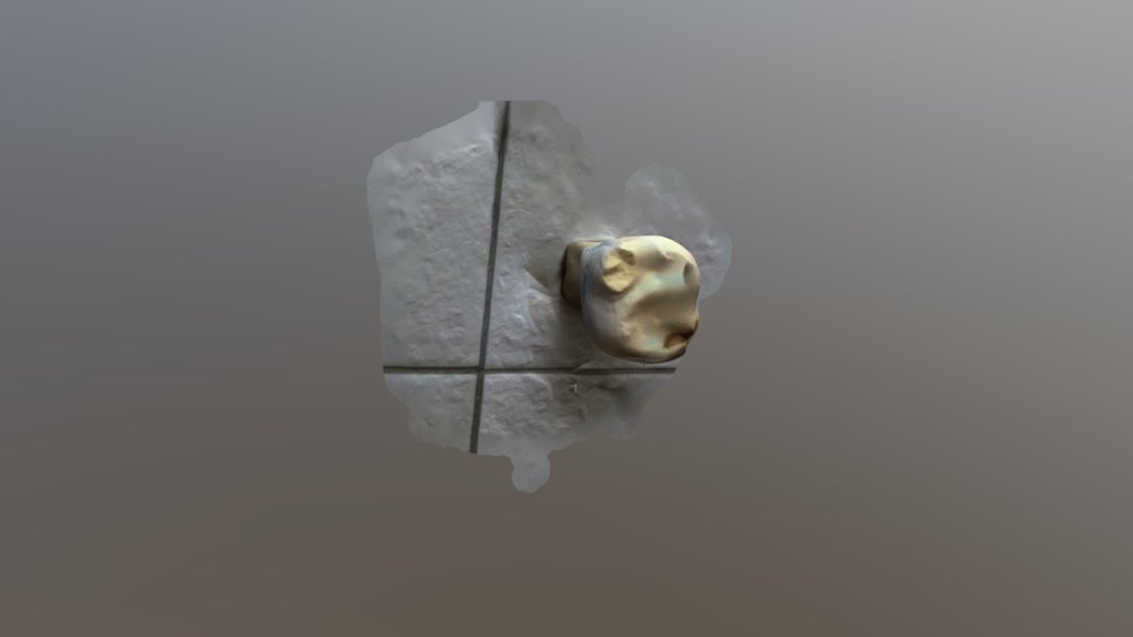 Tooth