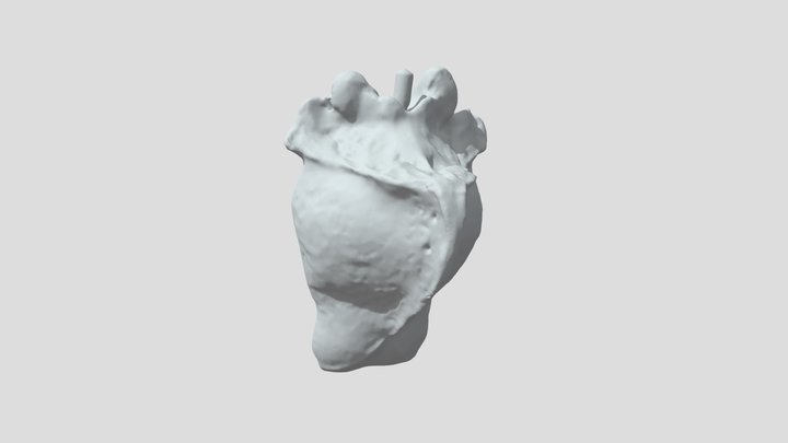Test Bone Scan 3D Model