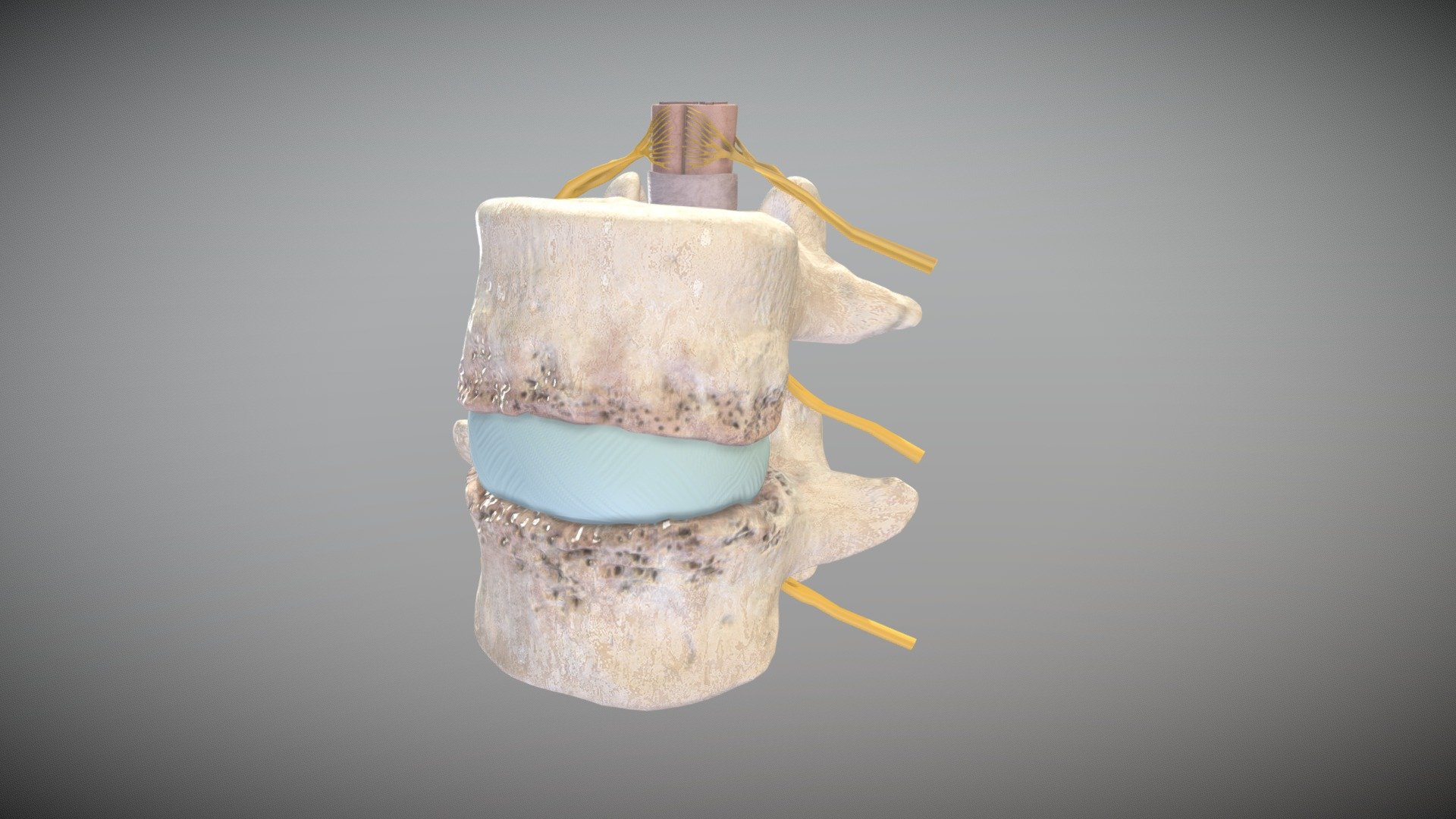 Eroded Vertebrae 3D model by imiridley [9da6e15] Sketchfab