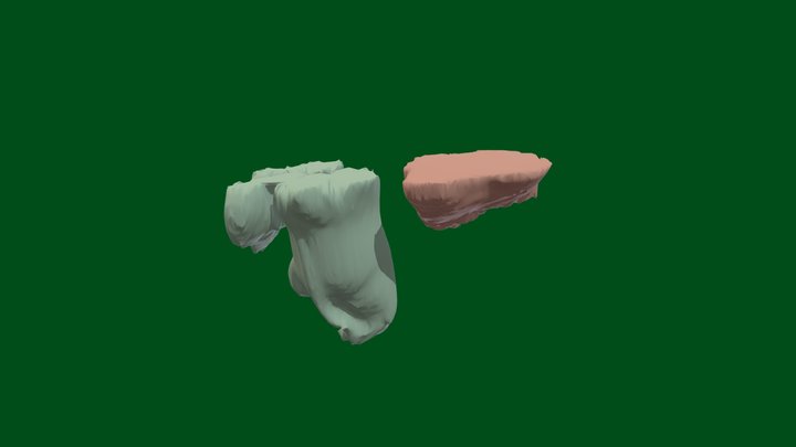 Rectum and Urinary Bladder 3D Model