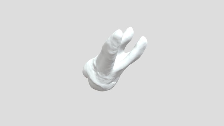 Tooth - ULM1 11-3-25 3D Model