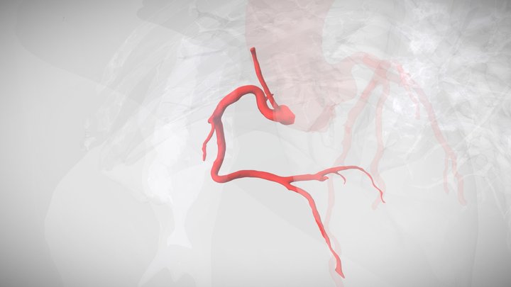 Coronaria derecha / Right Coronary artery 3D Model