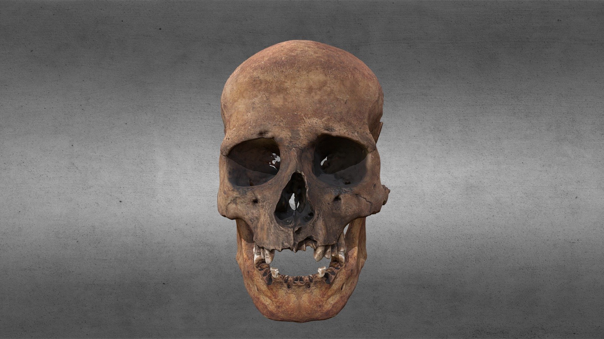 Skull of an ancient noble Magyar — Sketchfab embed 3D viewer