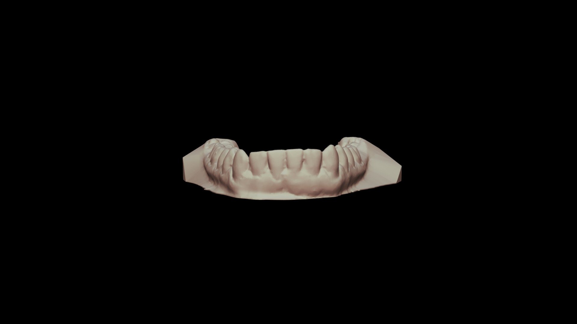 Patient 3: Mandibular Cast - 3D model by bchui [9e8e1c4] - Sketchfab
