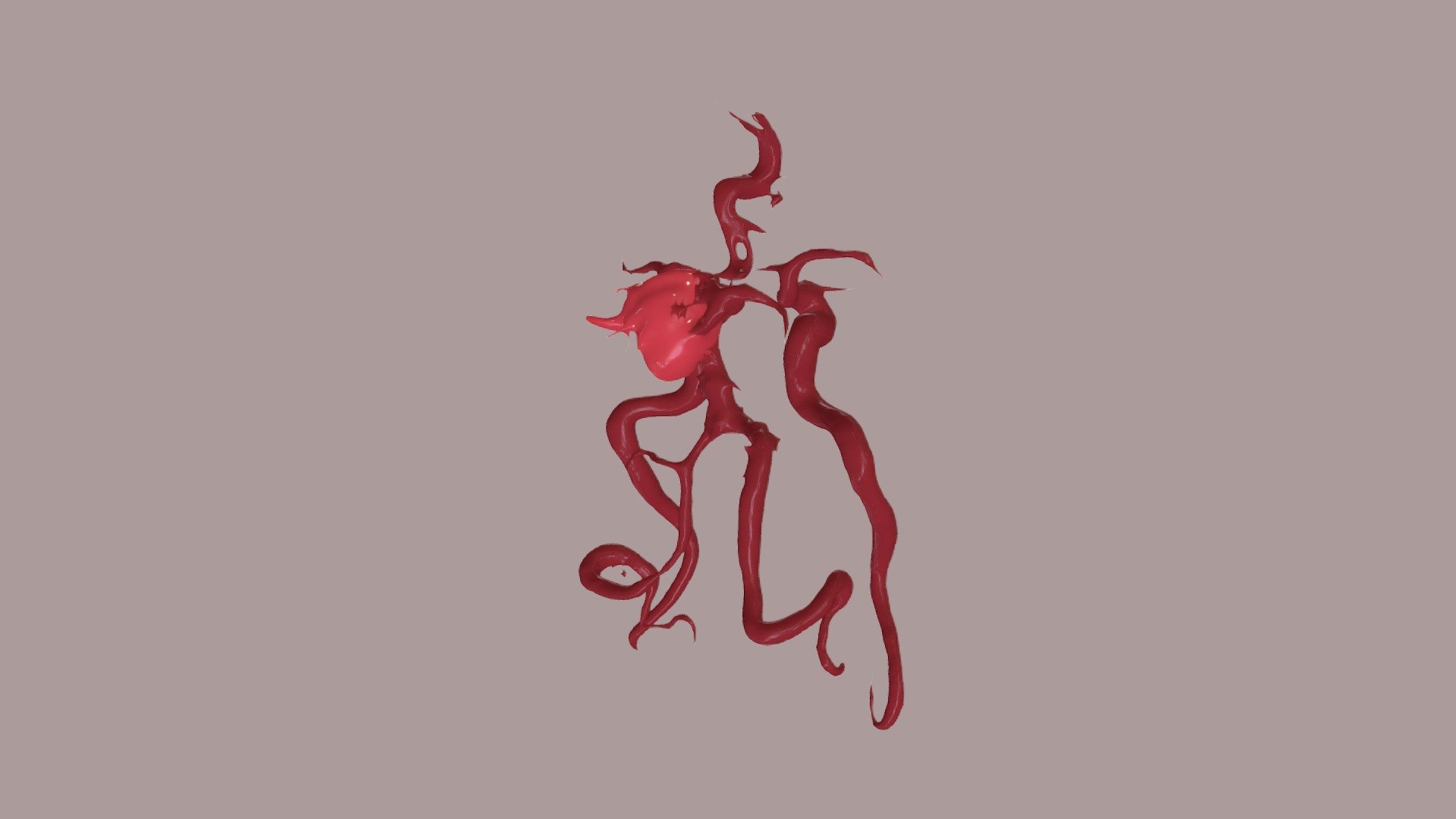 Saccular Aneurysm — Sketchfab embed 3D viewer