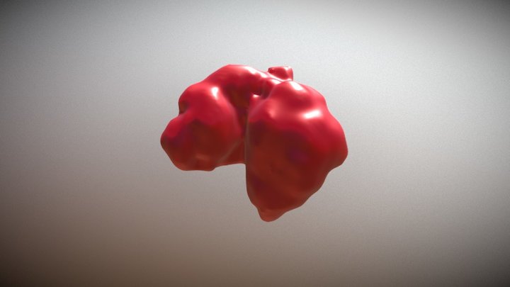 Tumor3 3D Model