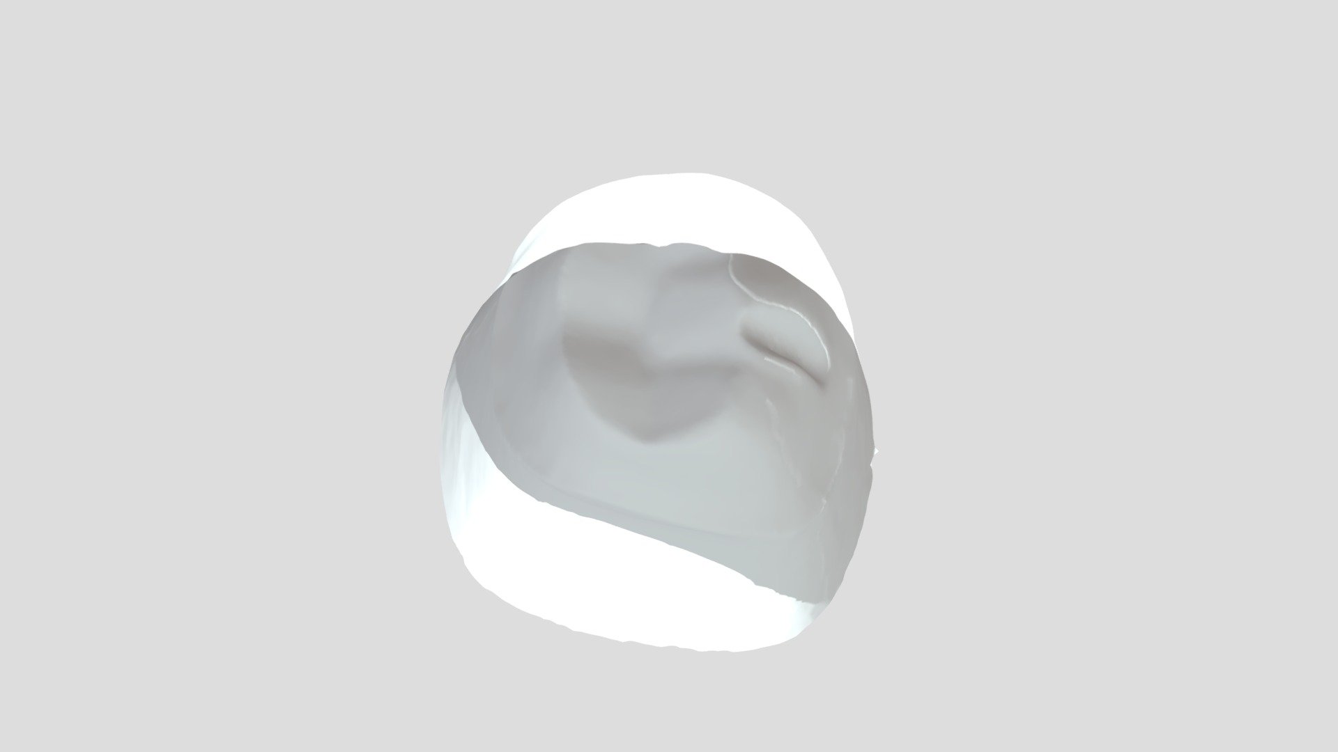 #30 Yellow Tooth Prep - 3D model by cmsession01 [9ef350c] - Sketchfab