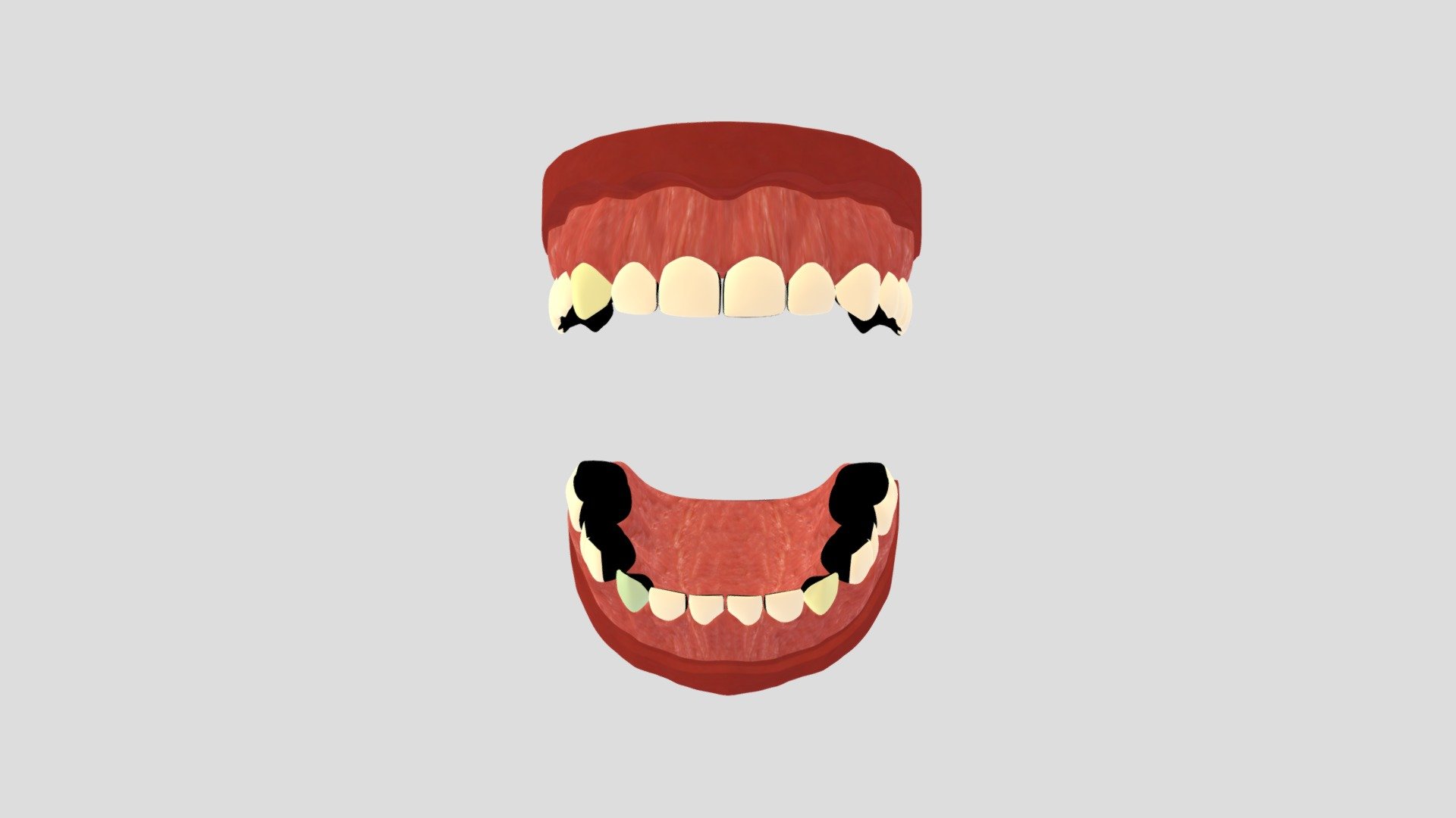hypo