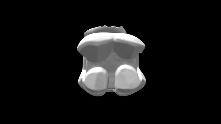 #19 Gold Onlay 3D Model