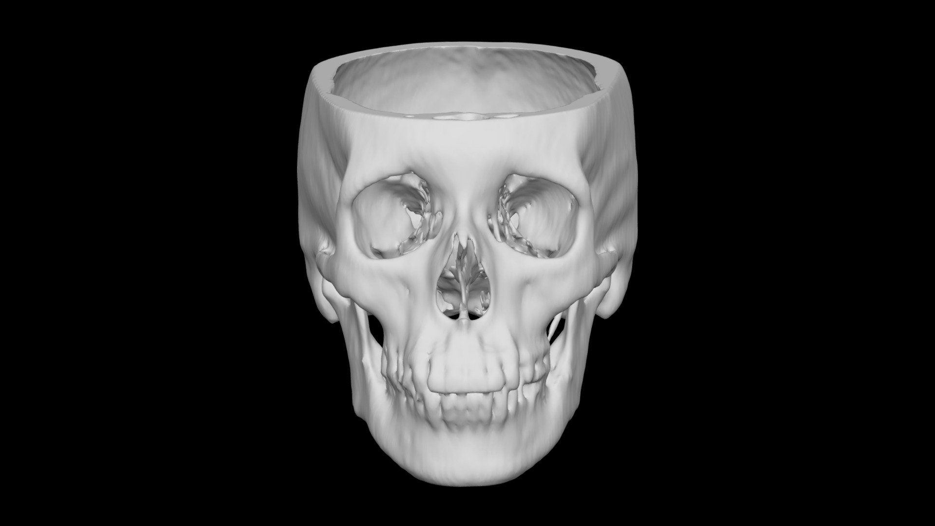 Skull Female 58yo