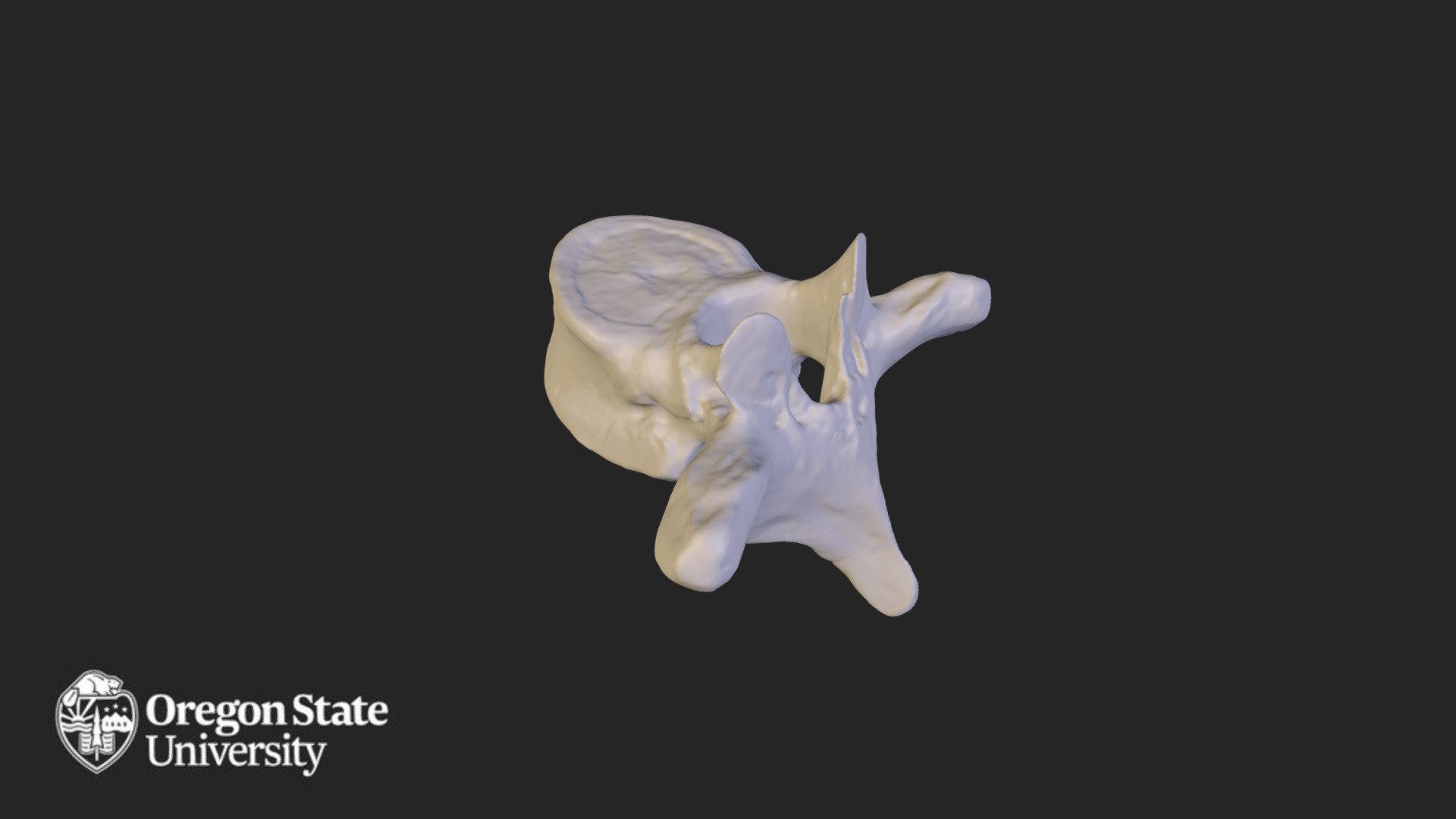 Thoracic vertebra - T7