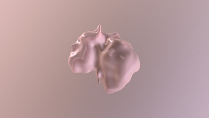 Big Tumor 3D Model
