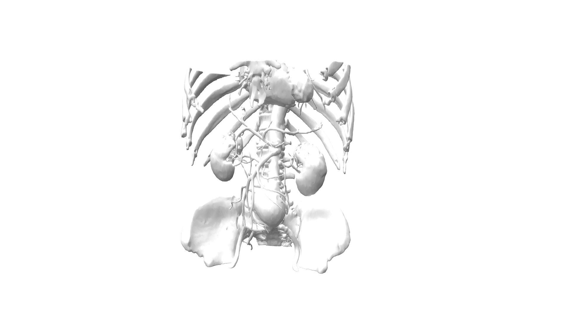 3D model Abdomen CT scan - This is a 3D model of the Abdomen CT scan. The 3D model is about a close-up of a robot.