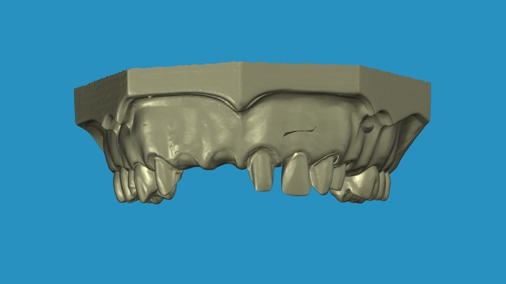 Maxillary arch 3D Model