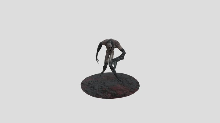 patient number 7 3D Model