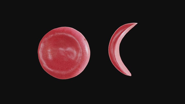 Normal vs Sickle Red Blood Cell 3D Model