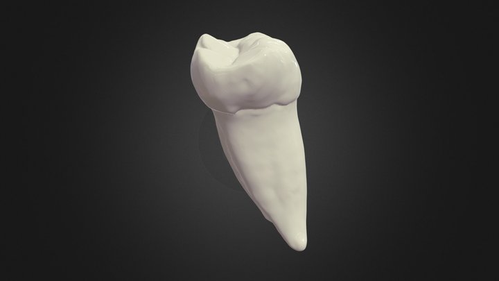 Mandibular 1st molar and pulp 3D Model