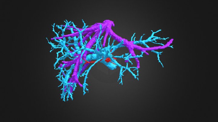 3grafts-0506 3D Model