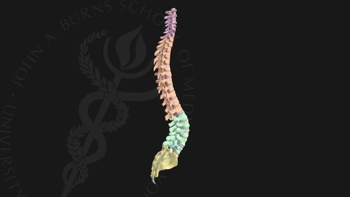 Lumbar Lordosis 3D Model