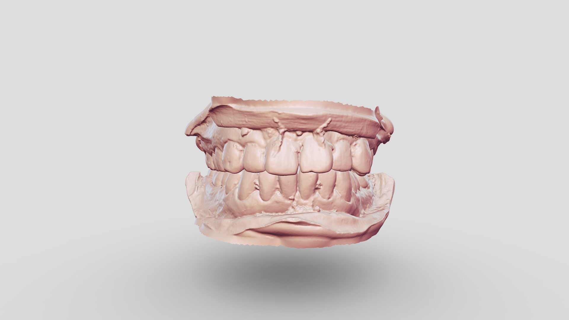 Bite Scan By Thunk3d Dt300 3d Model By Thunk3d 3d Scanner Lily Qin1 [a0224cb] Sketchfab