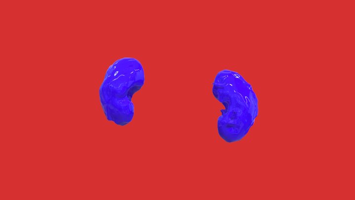 Segmentation_kidney 3D Model