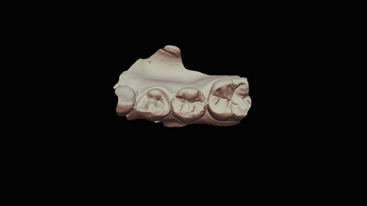 Group #15 Tooth #20 - Tooth 2 of 2 3D Model