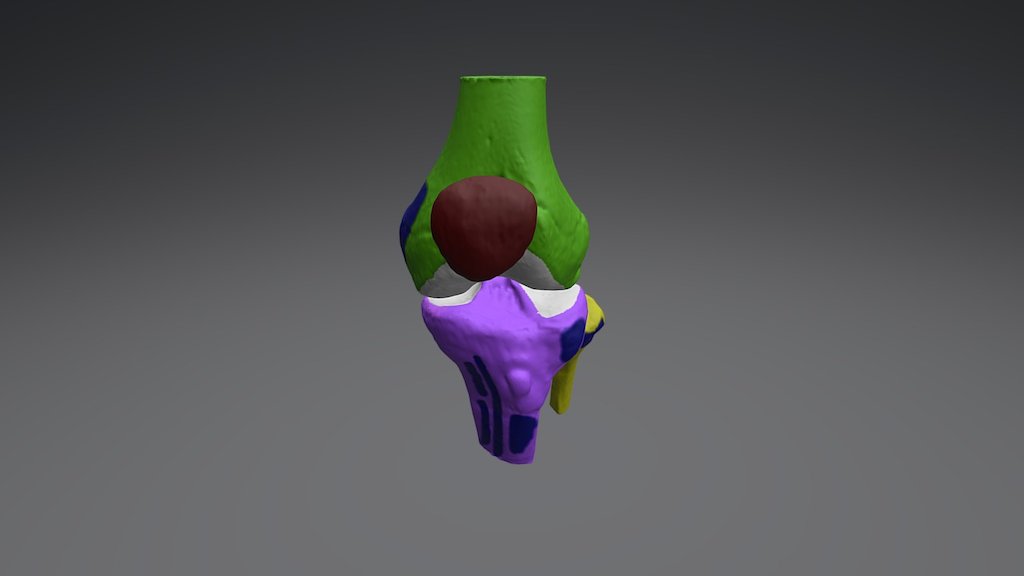 Knee - 3D model by Clínica 3D (@clinica3d) [a124008] - Sketchfab