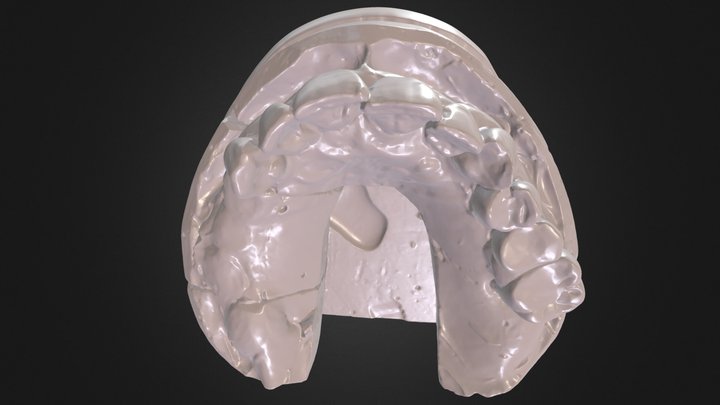 Maxillary Arch Case LL 3D Model