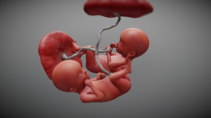 Fetus Twins Test 3D Model