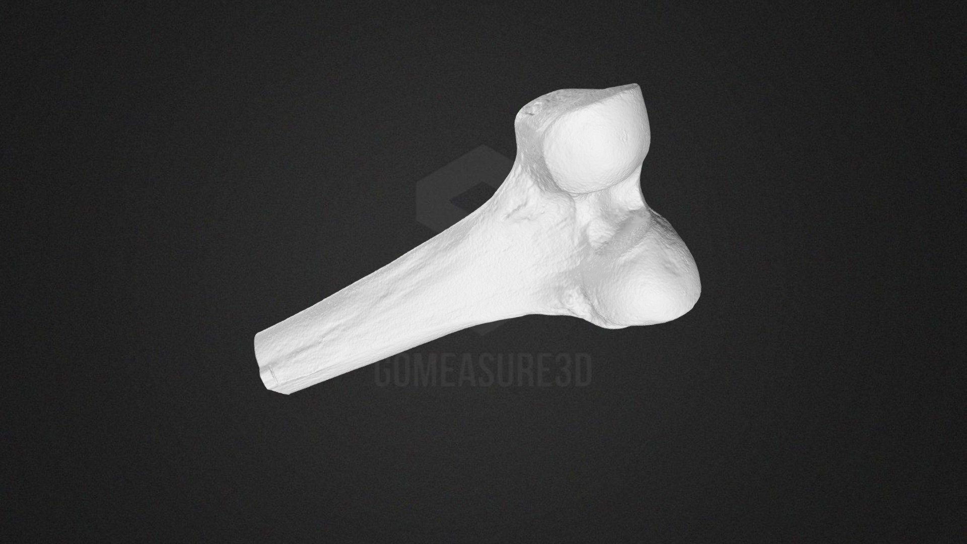 Femur Bone 3D Scan