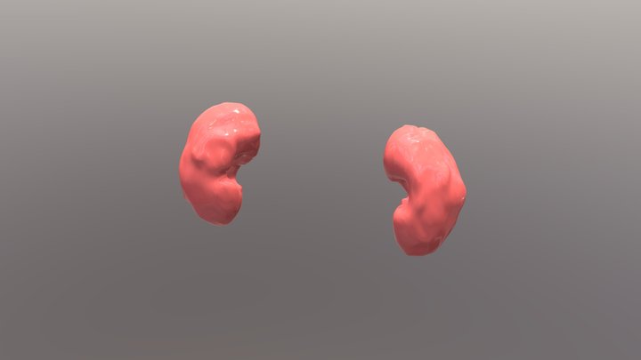 Kidneys 3D Model