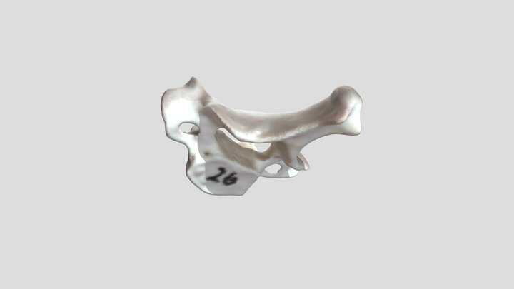 C7 vertebrae - annotated 3D Model