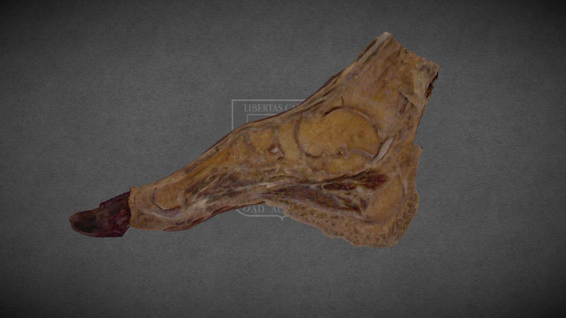 Saggital Section of the Foot / Corte Sagial Pie - Buy Royalty Free 3D ...