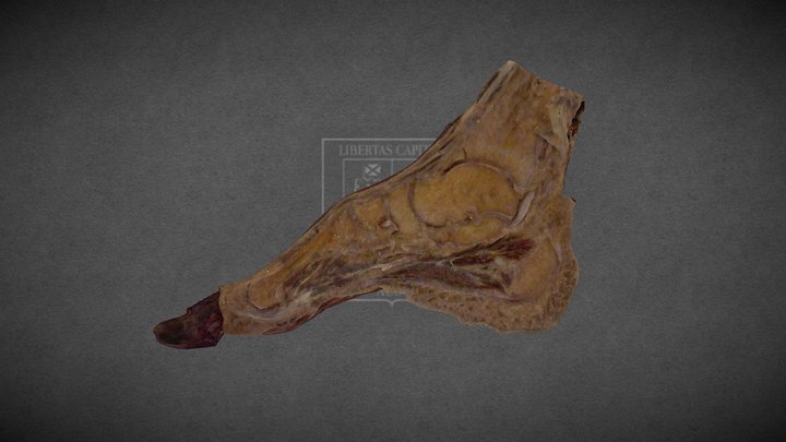 Saggital Section of the Foot / Corte Sagial Pie 3D Model