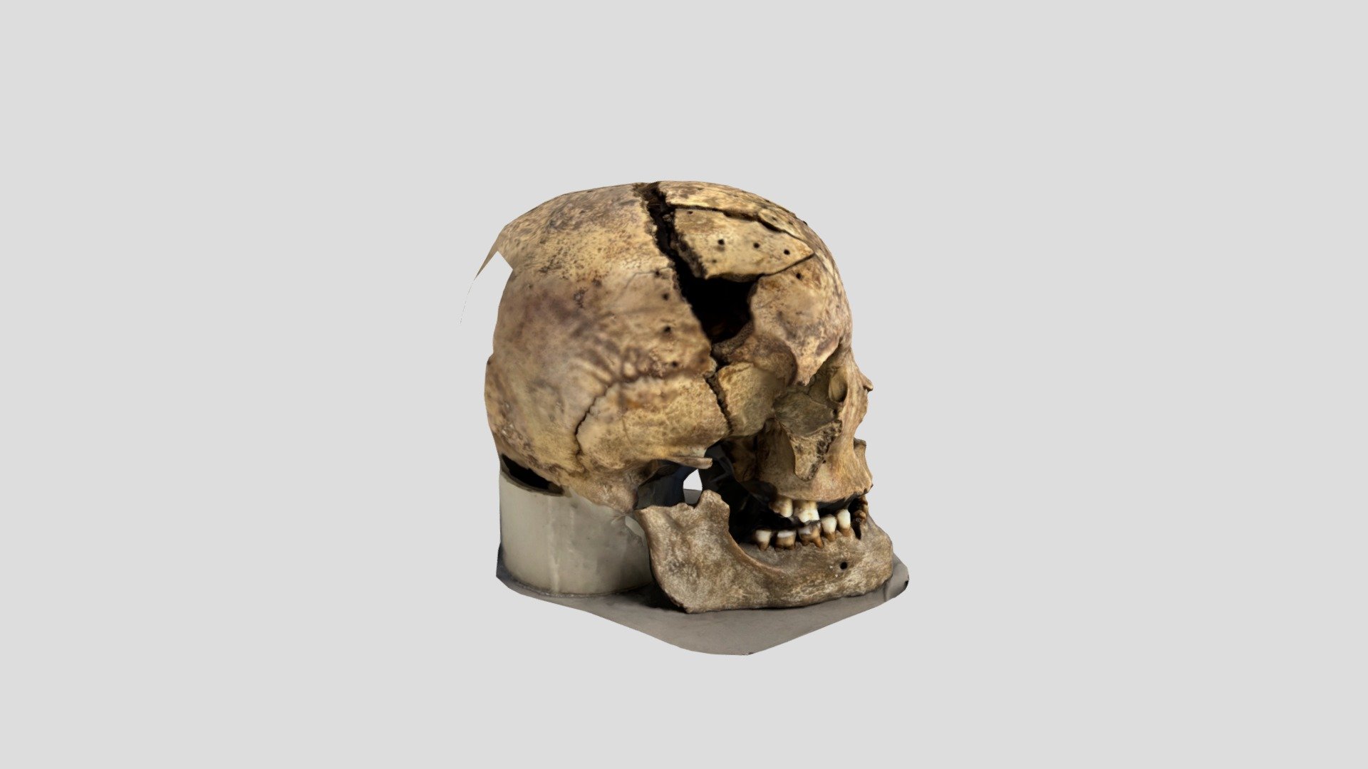 Skeleton
