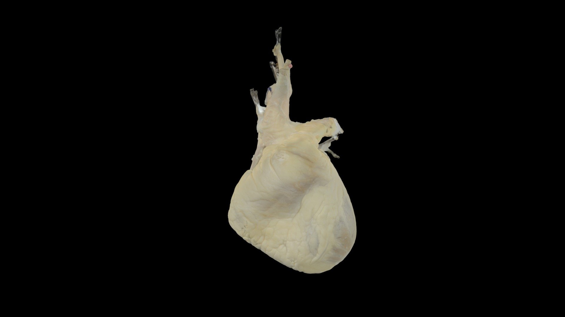 Human Heart #0566 External Anatomy