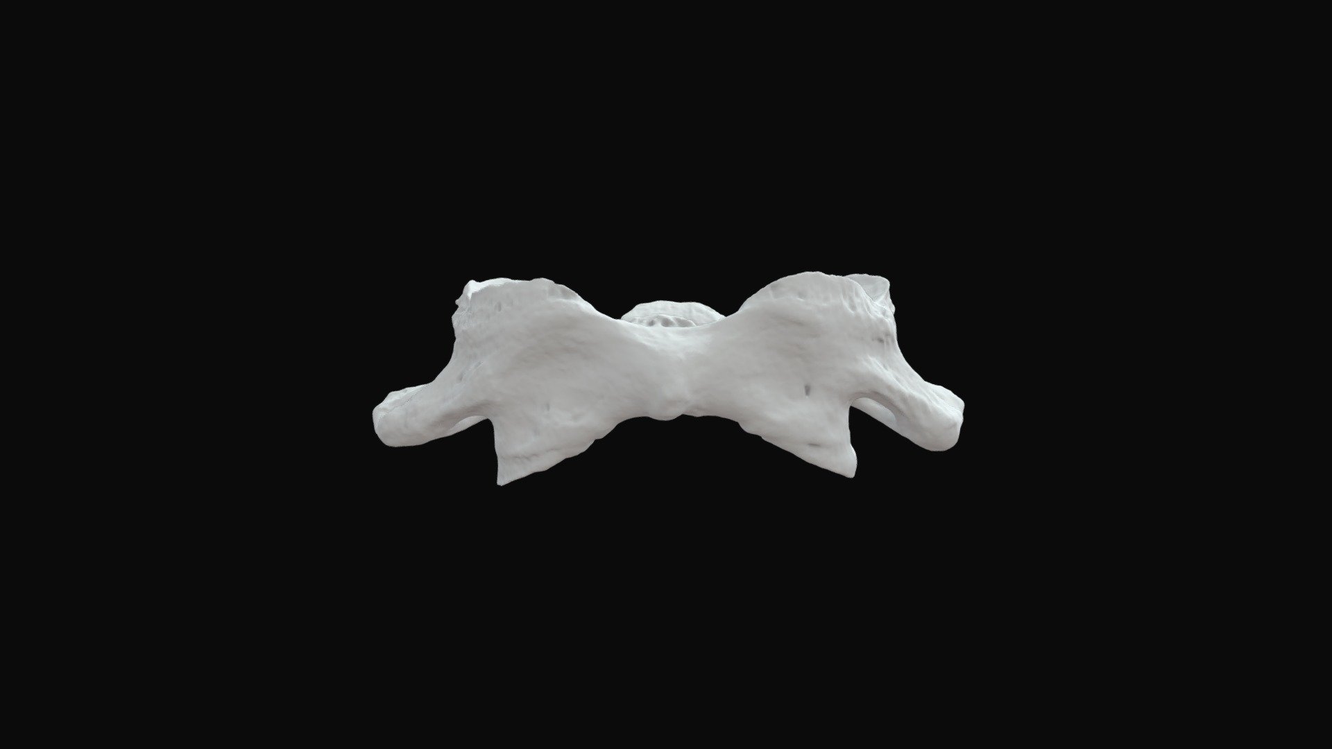 Atlas Vertebrae