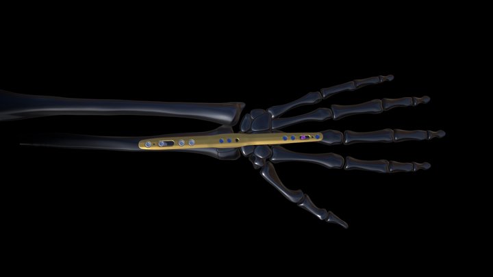 Xpert wrist - Spanning plate 3D Model