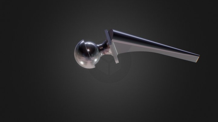 Hip Replacement 3D Model