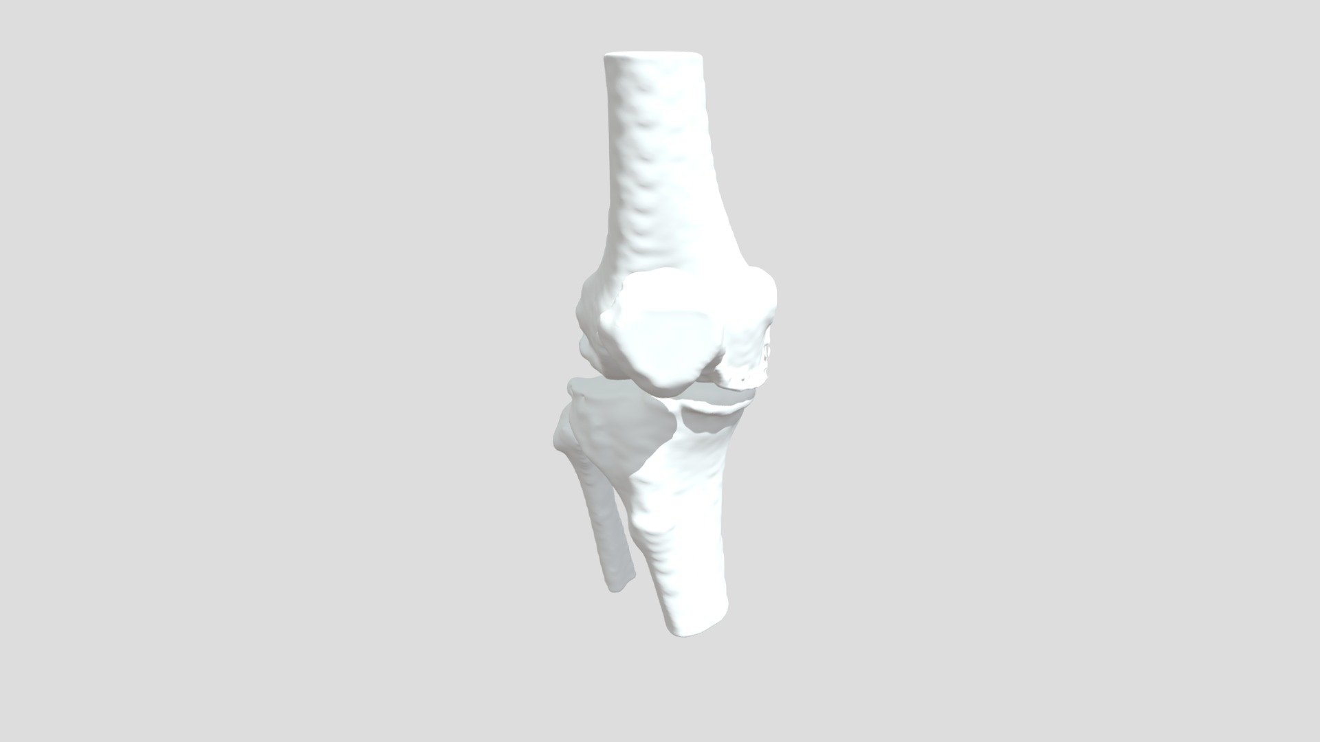 Segmentation Shil Sh Rt Bone