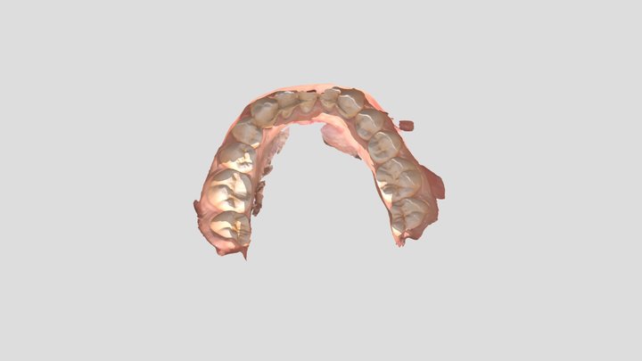 Reto diagnóstico UD8-Arcada mandibular 3D Model