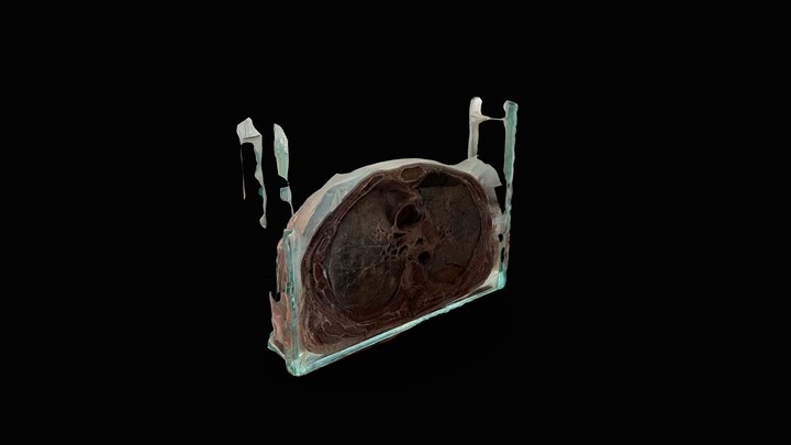 CORTE AXIAL DE TÓRAX NIVEL T2-T3 (MEDIASTINO) 3D Model