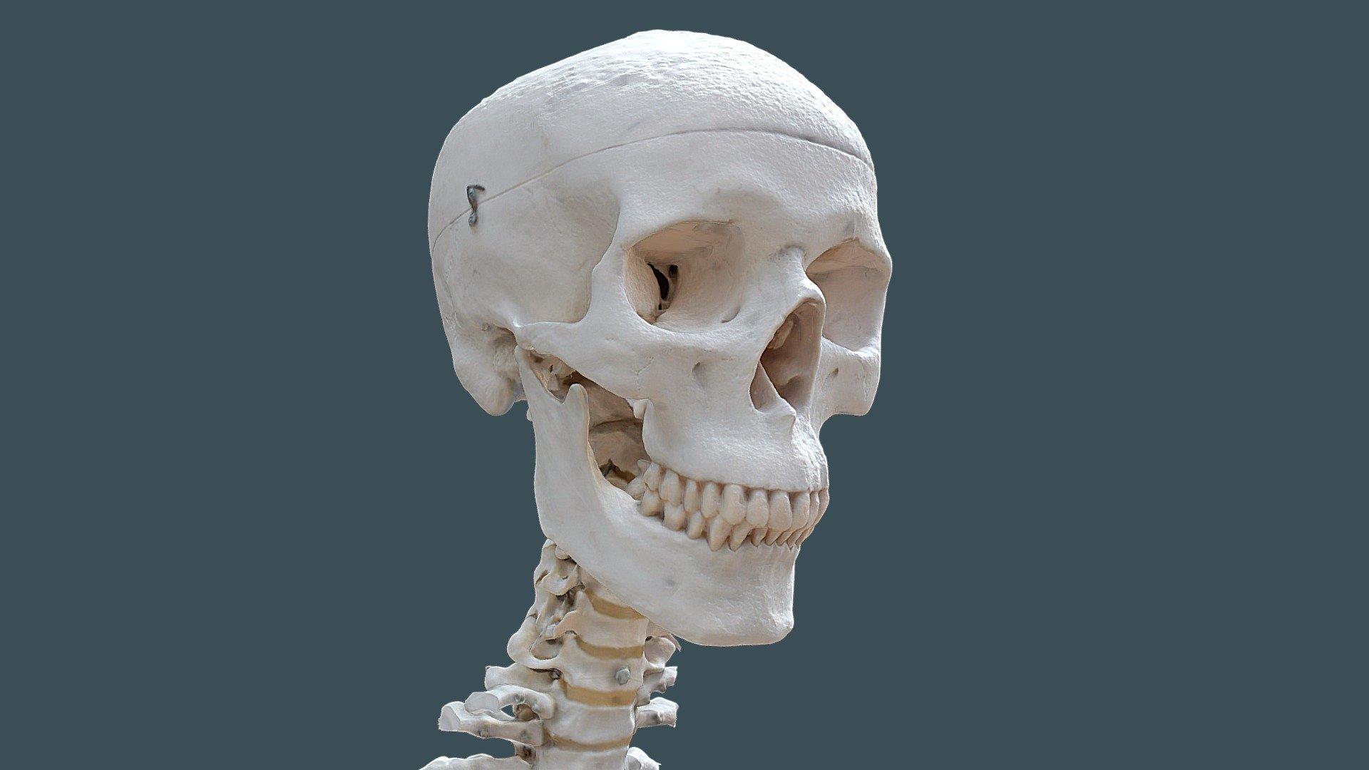 Human skull and neck