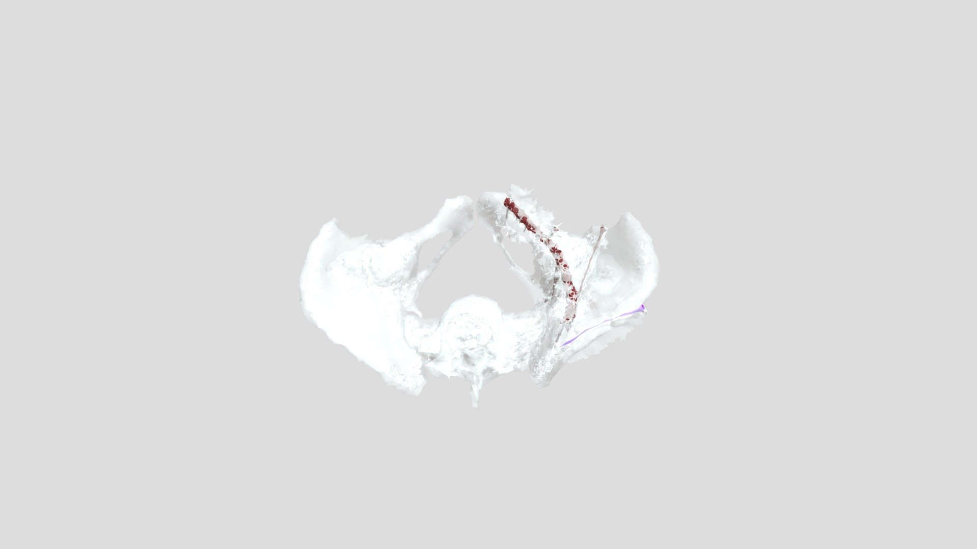 Rajic_Individual_Segmentation