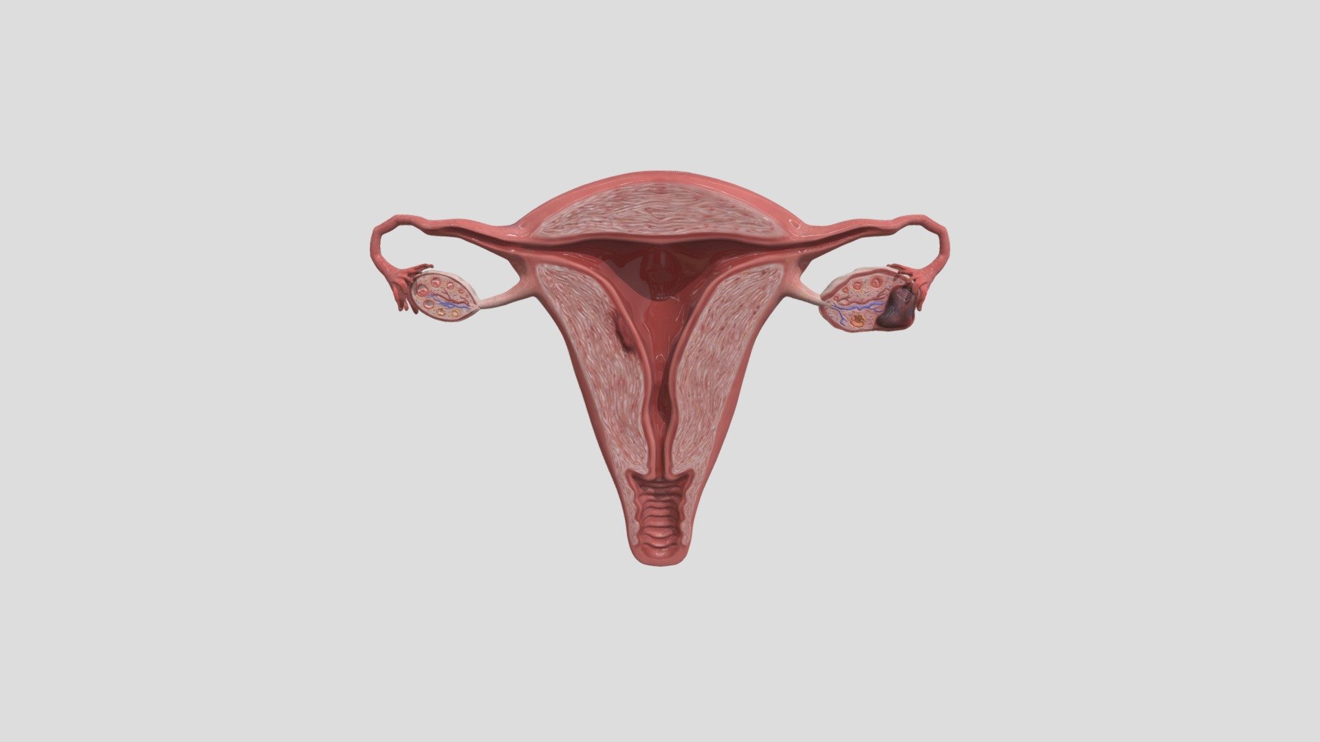 Coronal_crosssection_of_uterus_with_endo 3D model by Aptiq.ch
